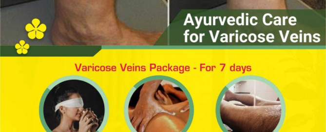 Say goodbye to discomfort caused by varicose veins with JSS Ayurveda's holistic care. 🌿 Embrace natural healing for healthier, pain-free legs!